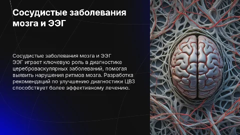Роль ЭЭГ в диагностике сосудистых заболеваний головного мозга