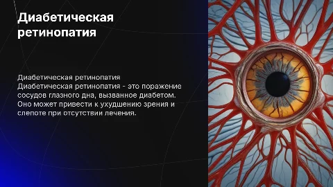 диабетическая ретинопатия проявление диабета на глазном дне