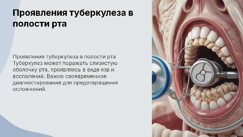 проявления туберкулеза в полости рта