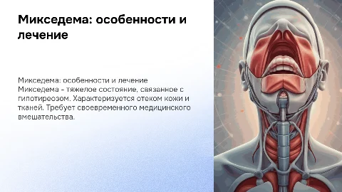 Микседема
