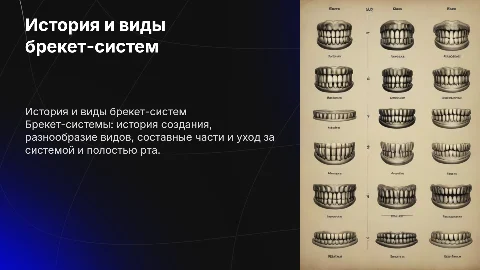 Брекет-системы: история, виды и уход за ними