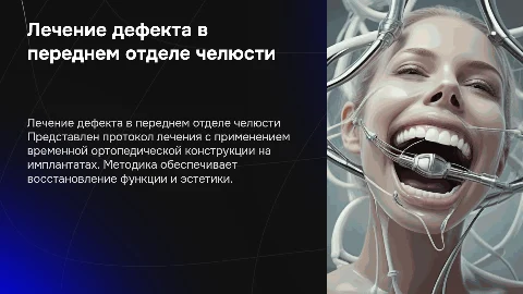 Протокол лечения дефекта челюсти с временной конструкцией
