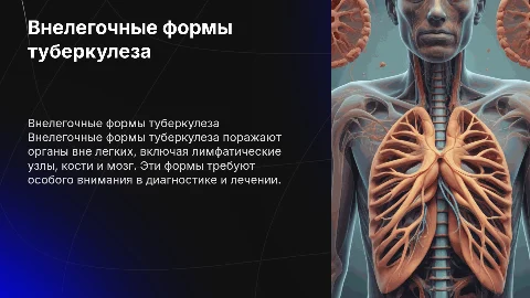 Внелегочные формы туберкулеза