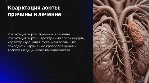 коарктация аорты