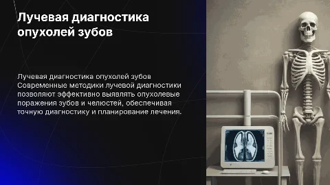 лучевая диагностика опухолевых поражениий зубов и челюстей