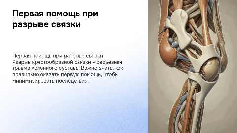 первая помощь при разрыве крестообразной связки