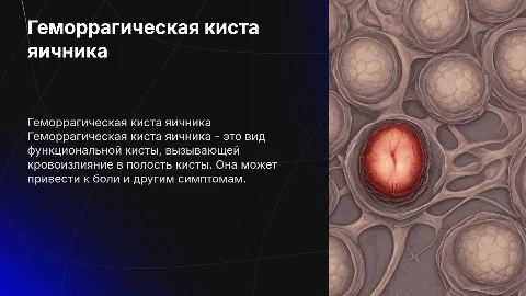 геморрагическая киста яичника