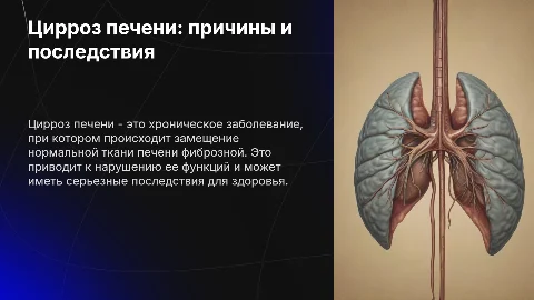 Цирроз печени