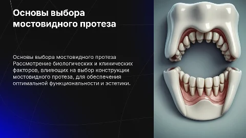 Биологические и клинические основы мостовидного протеза