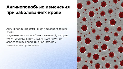 ангиноподобные изменения при системных заболеваниях крови