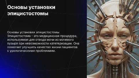 Презентация на тему эпицистостома