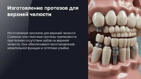 Съемные пластиночные протезы на верхнюю челюсть: технология