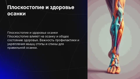 Плоскостопие и профилактика осанки