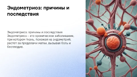 Эндометриоз