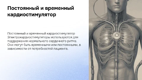 Постоянный и временный электрокардиостимулятор