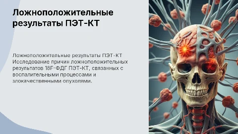 Ложноположительные результаты 18F-ФДГ ПЭТ-КТ: воспаление vs. опухоль