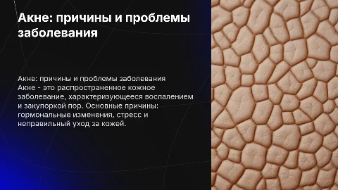Акне. Проблемы и причины заболевания