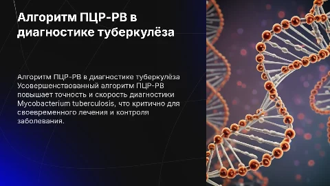 Усовершенствованный алгоритм ПЦР-РВ в диагностике туберкулеза