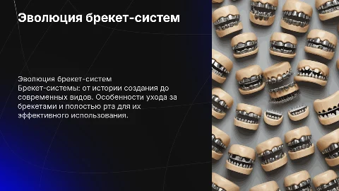 Брекет-системы: история, виды и уход за ними