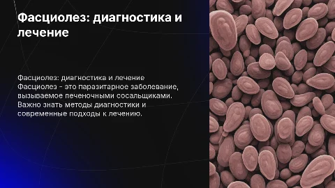 Фасциолез