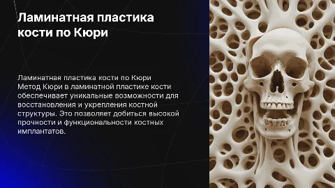 Ламинатная пластика кости по методу Кюри