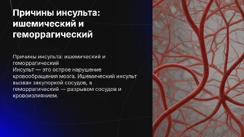 Причины ишемического и геморрагического инсульта