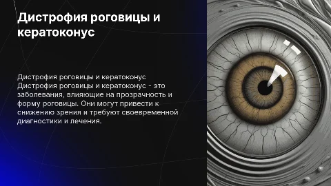 Без картинок дистрофия роговицы глаза и кератоконус