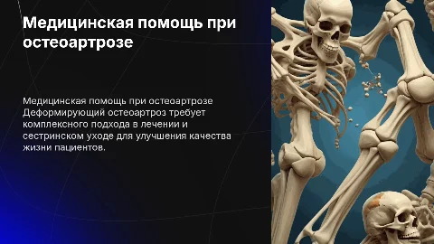 Оказание медицинской помощи при деформирующем остеоартрозе