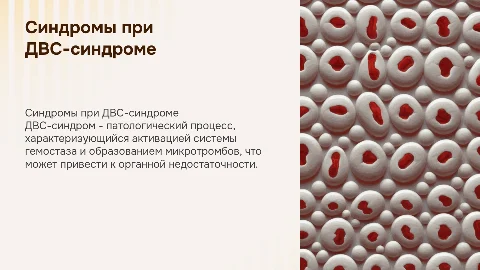 двс синдромы
