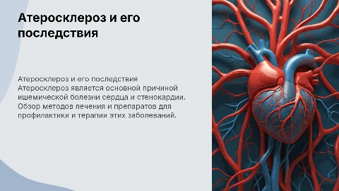 Атеросклероз и методы лечения: презентация для специалистов