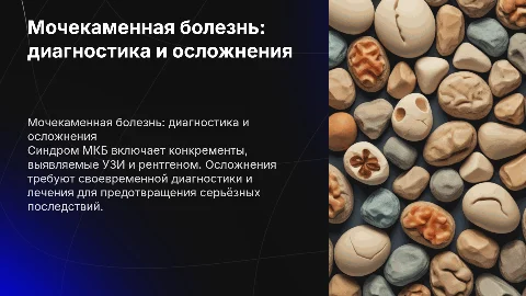 Синдром мочекаменной болезни: диагностика и осложнения