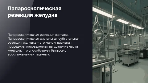 Лапароскопическая дистальная субтотальная резекция желудка