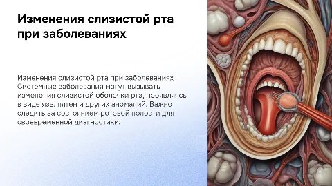 Изменение слизистой оболочки полости рта при заболеваниях