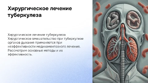 Тема «Хирургическое лечение туберкулеза органов дыхания»