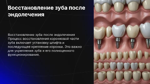 Особенности восстановления коронковой части после эндолечения