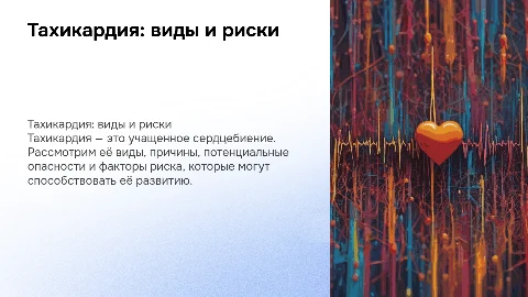 тахикардия виды причины опасность и факторы риска