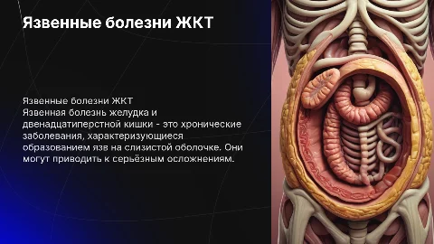 язвенную болезнь желудка и язвенную болезнь двенадцатиперстной кишки