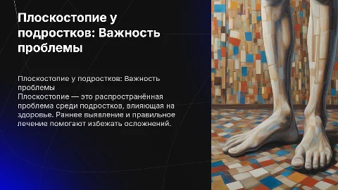 Плоскостопие у подростков