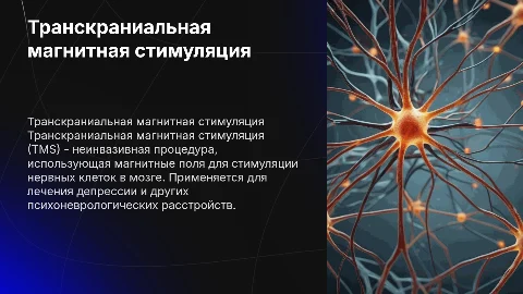 транскраниальная магнитная стимуляция