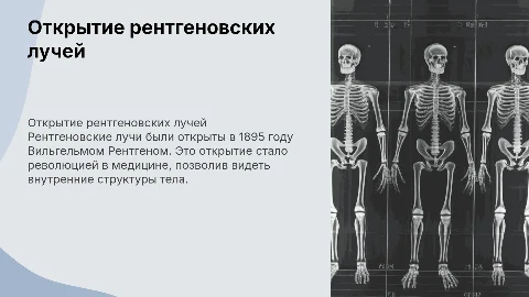 открытие рентгеновских лучей
