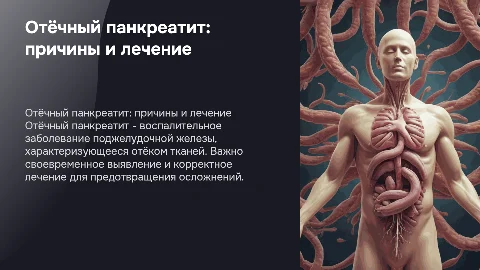 отёчный панкреатит