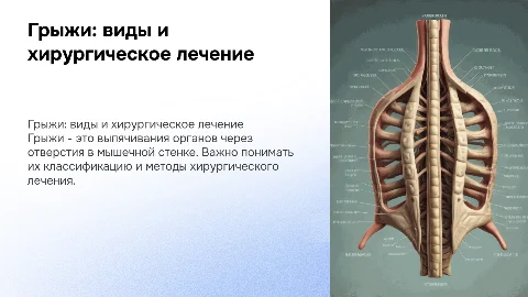 Грыжи: виды, классификация и хирургическое лечение