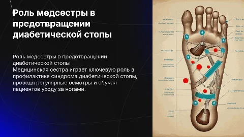 Роль медицинской сестры в профилактике диабетической стопы