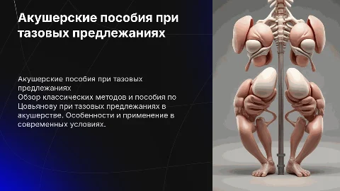 Акушерские пособия при тазовых предлежаниях: методы и рекомендации