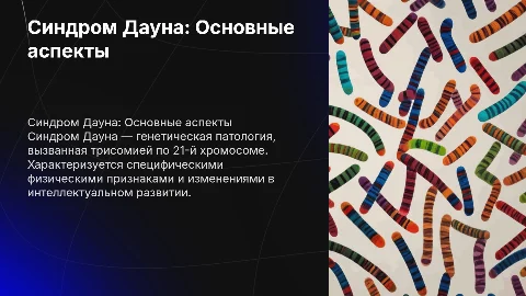 синдром дауна