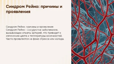 синдром рейно