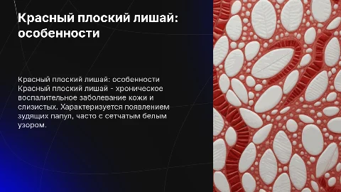 Красный плоский лишай