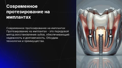 протезирование на имплантах