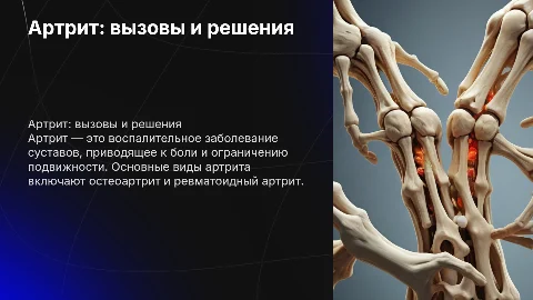 Презентация студента медика на тему артрит