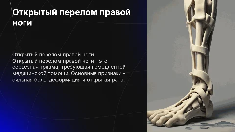 Открытый перелом ноги правой